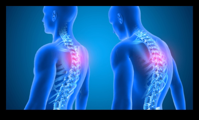 Stați în picioare, ridicați greutăți și trăiți fără durere Un ghid pentru antrenamente de postură perfectă 4 Postura perfectă: îmbunătățirea formei pentru antrenamente sigure și eficiente